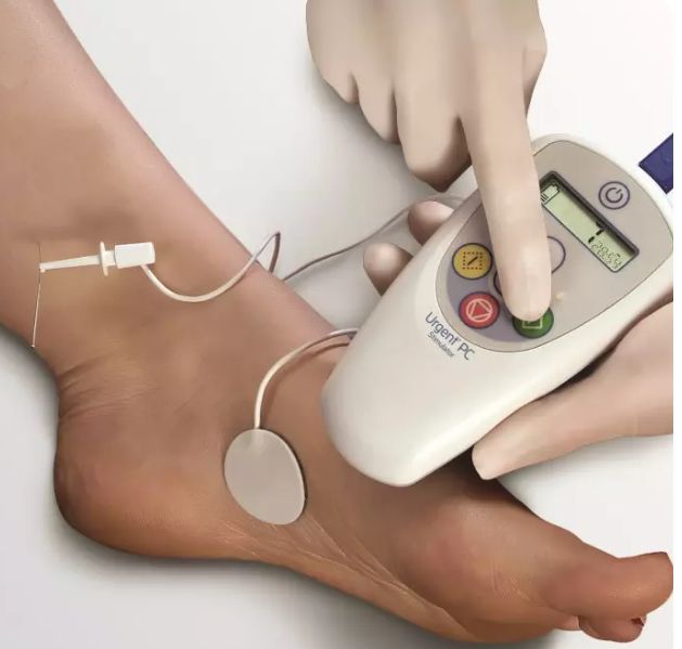 PTNS-Stimulationsgerät