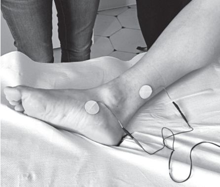 PTNS-Elektrodenplatzierung